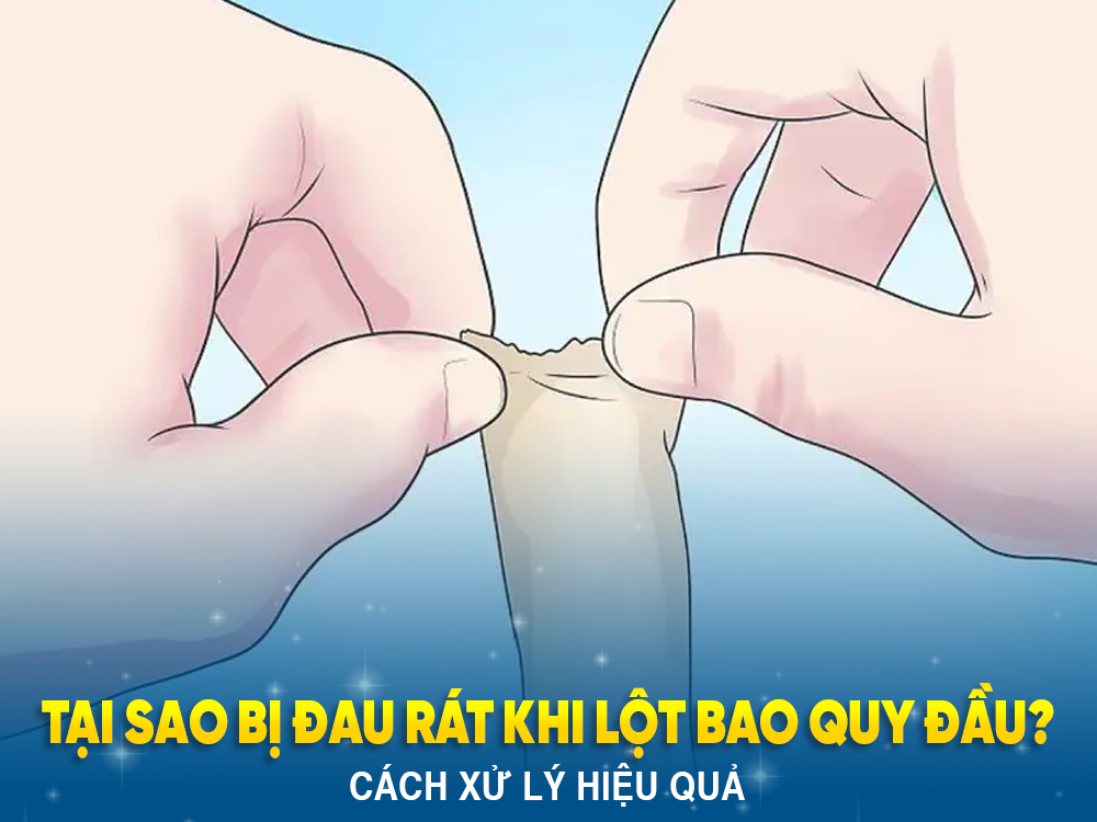 4. Biện pháp điều trị đau bao quy đầu