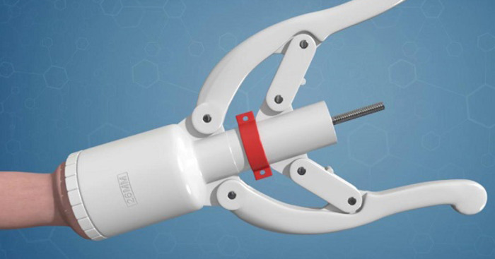 Cắt bao quy đầu bằng máy Stapler