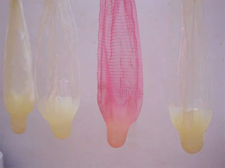 Nguyên nhân gây tinh dịch màu vàng là gì?