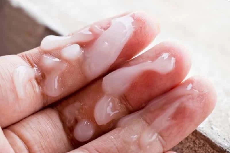 Tinh dịch vón cục có nguy hiểm không?