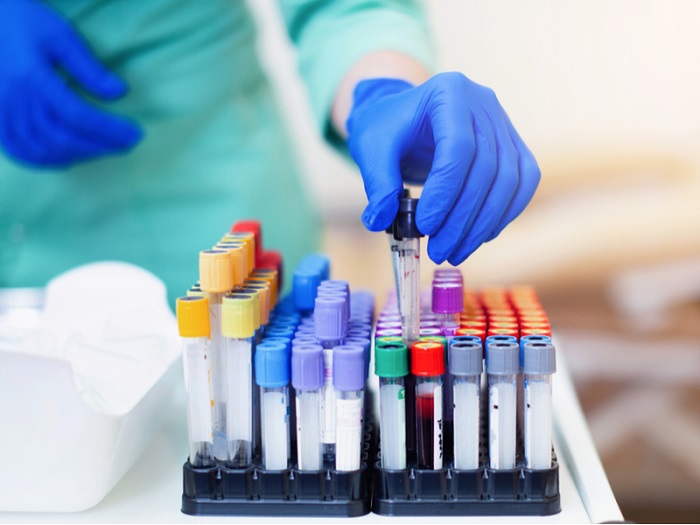 Xét nghiệm nam khoa bao gồm những gì?